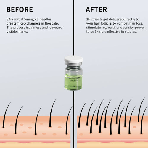 AlphaInfusion™ Hair Regrowth System